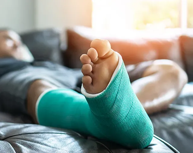 Image of a patient lying down with a cast on their foot - foot fracture